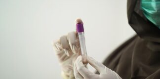 Czy badanie CCP jest refundowane przez NFZ?